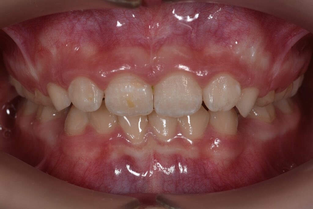 Фото 4 — Эффективные методы лечения артрита с помощью ортопедических матрасов