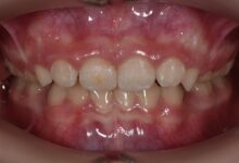 Photo of Эффективные методы лечения артрита с помощью ортопедических матрасов