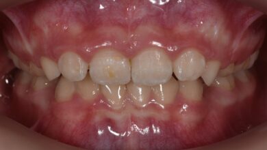 Photo of Эффективные методы лечения артрита с помощью ортопедических матрасов