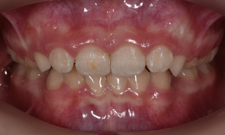 Photo of Эффективные методы лечения артрита с помощью ортопедических матрасов