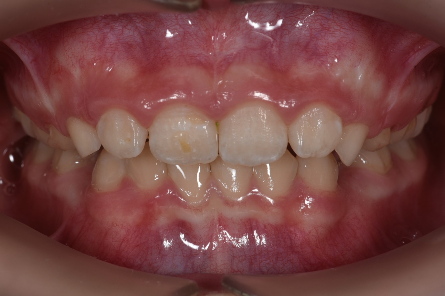 Фото 4 — Эффективные методы лечения артрита с помощью ортопедических матрасов